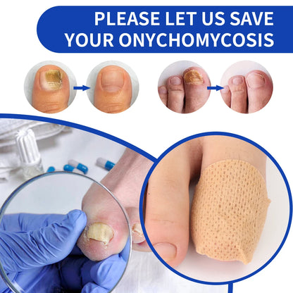 Nail Repair Patch